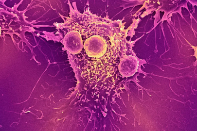 Kanserden Korkma Geç Kalmaktan Kork