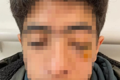 15 yaşındaki çocuk muştayla öldüresiye dövüldü!