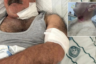 Severek beslediği hayvan bu hale getirdi! Ölümden kıl payı kurtuldu...