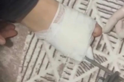 Osmaniye’de korkutan kaza: Ayağına mangal şişi saplanan çocuk hastaneye kaldırıldı