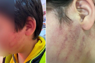 Bu kadarına da pes! Veliler okulda 8 yaşındaki çocukları dövdü