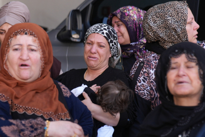 Burun ameliyatına giren genç kadın öldü!