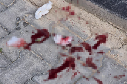 Cadde ortasında korkutan saldırı: 16 yaşındaki çocuk bıçaklandı