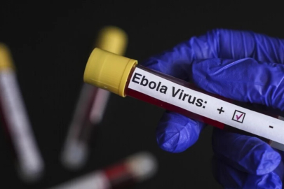 Nijerya'da Ebola alarmı! Tablo kötüleşiyor...