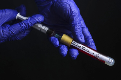 DSÖ'den ölümcül Ebola virüsüyle ilgili uyarı!