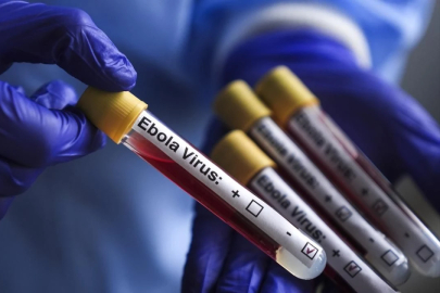 "Tarihin en ölümcül seviyesine ulaşabilir" ABD'den Ebola virüsü uyarısı!