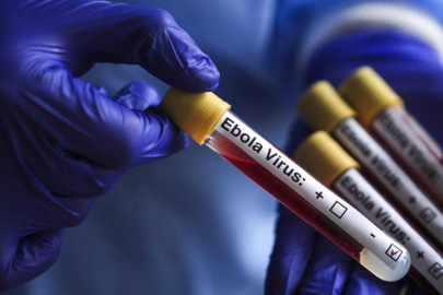 DSÖ'den Ebola uyarısı: Virüsü kontrol edemiyoruz
