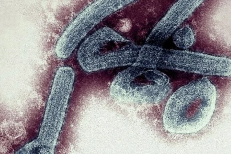 Gana'da iki kişi Marburg virüsü nedeniyle hayatını kaybetti!