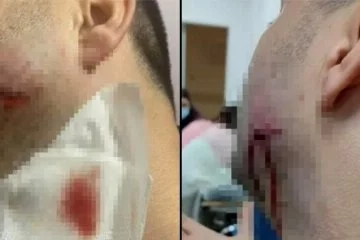 Tekirdağ'da sağlık çalışanlarına saldırı iddiası! Jandarma personeli açığa alındı
