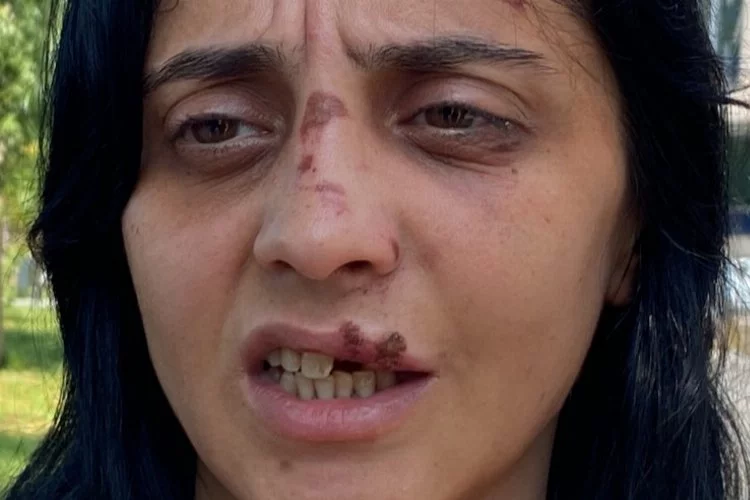 Zonguldak'ta genç kadın tanımadığı kişinin saldırısına uğradı